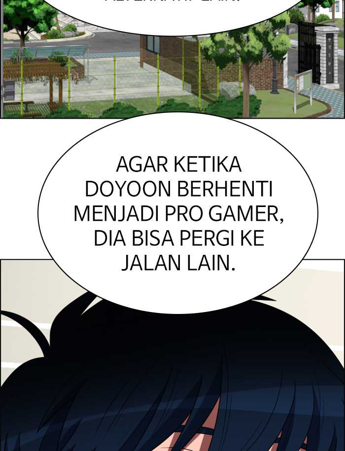 No Scope